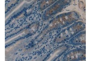 Immunohistochemistry (IHC) image for anti-Matrix Metallopeptidase 9 (Gelatinase B, 92kDa Gelatinase, 92kDa Type IV Collagenase) (MMP9) (AA 226-391) antibody (ABIN7432019)