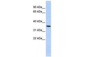 Image no. 1 for anti-Progestin and AdipoQ Receptor Family Member VI (PAQR6) (AA 72-121) antibody (ABIN6741069) (PAQR6 抗体  (AA 72-121))