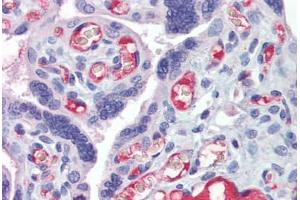 Placenta, Human: Formalin-Fixed, Paraffin-Embedded (FFPE) (HMOX1 抗体)
