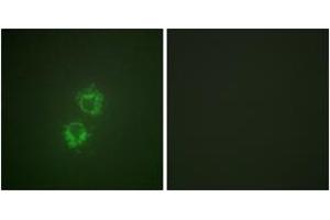 Immunofluorescence analysis of HeLa cells, using 14-3-3 thet/tau (Phospho-Ser232) Antibody. (14-3-3 theta 抗体  (pSer232))