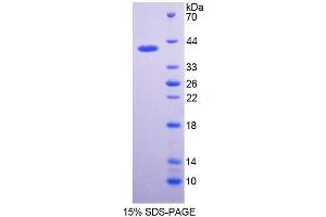 SDS-PAGE analysis of Rabbit Interferon alpha Protein. (IFNA 蛋白)