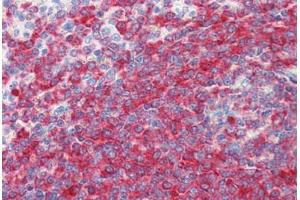 Human Spleen (formalin-fixed, paraffin-embedded) stained with PDCD4 antibody ABIN364343 at 5 ug/ml followed by biotinylated anti-mouse IgG secondary antibody ABIN481714, alkaline phosphatase-streptavidin and chromogen. (PDCD4 抗体  (AA 1-469))