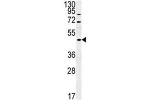 Western Blotting (WB) image for anti-Fused in Sarcoma (FUS) (AA 499-526) antibody (ABIN3031006)