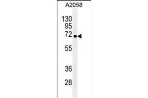 Western blot analysis in A2058 cell line lysates (35ug/lane). (GAB4 抗体  (N-Term))