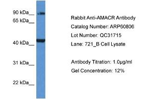 Western Blotting (WB) image for anti-alpha-Methylacyl-CoA Racemase (AMACR) (C-Term) antibody (ABIN2774297) (AMACR 抗体  (C-Term))