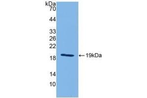 Detection of Recombinant IL18, Mouse using Polyclonal Antibody to Interleukin 18 (IL18) (IL-18 抗体  (AA 36-192))