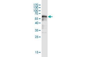 Western Blot detection against Immunogen (58. (BOD1L1 抗体  (AA 1-284))