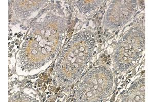 XRRA1 Mouse Monoclonal Antibody at 1/100 staining human normal colon tissue by IHC-P. (XRRA1 抗体)