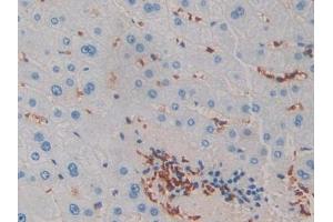 DAB staining on IHC-P; Samples: Human Liver Tissue (IL-2 抗体  (AA 21-153))