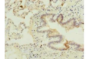 Immunohistochemistry of paraffin-embedded human lung tissue using ABIN7174888 at dilution of 1:100 (C7orf61 抗体  (AA 1-206))