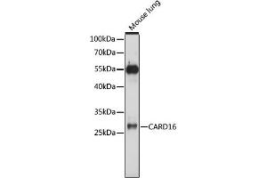 Western blot analysis of extracts of mouse lung, using C antibody (ABIN7266127) at 1:1000 dilution. (CARD16 抗体  (AA 50-150))