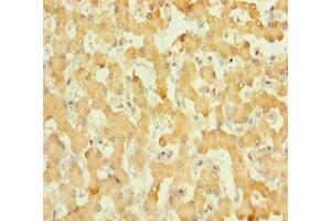 Immunohistochemistry of paraffin-embedded human liver tissue using ABIN7165010 at dilution of 1:100 (ABHD14B 抗体  (AA 2-210))