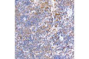 Immunohistochemistry of paraffin-embedded mouse spleen using TR Rabbit mAb (ABIN7270870) at dilution of 1:200 (40x lens). (TRAPPC2 抗体)