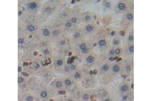 IHC-P analysis of Kidney tissue, with DAB staining. (Poliovirus Receptor 抗体  (AA 22-255))