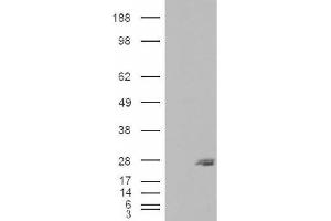 Image no. 1 for anti-SAR1 Homolog B (SAR1B) (Internal Region) antibody (ABIN375115) (SAR1B 抗体  (Internal Region))