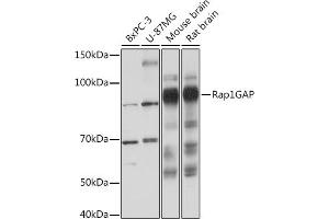 Western blot analysis of extracts of various cell lines, using Rap1GAP Rabbit mAb (ABIN1680949, ABIN3017895, ABIN3017896 and ABIN7101534) at 1:1000 dilution.