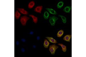 ABIN7094637 and ABIN7098687 staining Hela cells by IF/ICC.