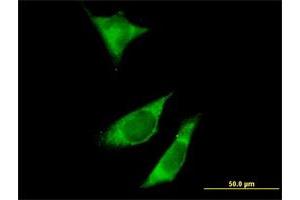 Immunofluorescence of purified MaxPab antibody to RPTOR on HeLa cell. (Raptor 抗体  (AA 1-379))