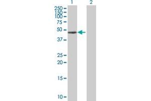 Western Blotting (WB) image for anti-Protein Kinase, CAMP-Dependent, Regulatory, Type I, alpha (Tissue Specific Extinguisher 1) (PRKAR1A) (AA 1-381) antibody (ABIN519181)