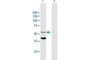 Western Blot analysis of CYP4F12 expression in transfected 293T cell line by CYP4F12 MaxPab polyclonal antibody. (CYP4F12 抗体  (AA 1-524))