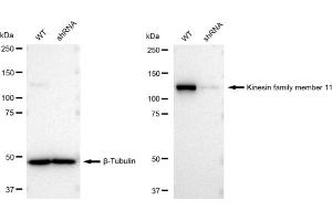 Western blotting analysis using Kinesin family member 11 antibody (ABIN7799200). (Recombinant KIF11 抗体)