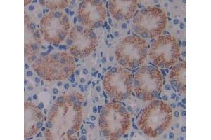 #VALUE! (HIBCH 抗体  (AA 1-170))
