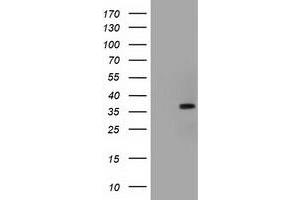 HEK293T cells were transfected with the pCMV6-ENTRY control (Left lane) or pCMV6-ENTRY ACAT2 (Right lane) cDNA for 48 hrs and lysed. (ACAT2 抗体)