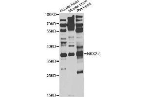 Western blot analysis of extracts of various cell lines, using NKX2-5 antibody (ABIN1876852) at 1:1000 dilution. (NK2 Homeobox 5 抗体)