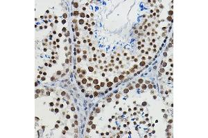 Immunohistochemistry (IHC) image for anti-Methyltransferase Like 14 (METTL14) (AA 1-210) antibody (ABIN6143759)