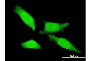 Immunofluorescence of monoclonal antibody to MTL5 on HeLa cell. (MTL5 抗体  (AA 399-508))