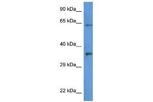 Western Blot showing CTSL2 antibody used at a concentration of 1 ug/ml against HT1080 Cell Lysate (Cathepsin L2 抗体  (C-Term))