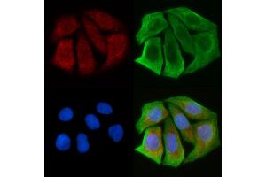 ABIN6257918 and ABIN6274883 staining Hela cells(30 min of UV treatment) by IF/ICC.