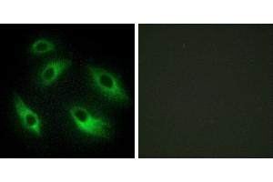 Peptide - +Immunofluorescence analysis of HeLa cells, using EPHB6 antibody. (EPH Receptor B6 抗体)