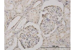 Image no. 1 for anti-Cold Shock Domain Protein A (CSDA) (AA 241-331) antibody (ABIN466130) (CSDA 抗体  (AA 241-331))