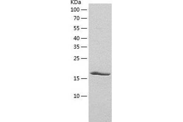 PCNP Protein (AA 1-178) (His tag)