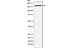 Western blot analysis of SMC4 expression in Ramos cell lysate.