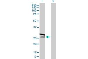 Western Blotting (WB) image for anti-ATPase, H+ Transporting, Lysosomal 31kDa, V1 Subunit E1 (ATP6V1E1) (AA 1-226) antibody (ABIN513634)