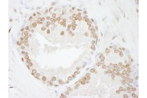 Immunohistochemistry (IHC) image for anti-SWI/SNF Related, Matrix Associated, Actin Dependent Regulator of Chromatin, Subfamily C, Member 2 (SMARCC2) (C-Term) antibody (ABIN7448801)