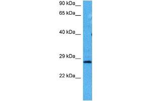 Host:  Mouse  Target Name:  HPRT1  Sample Tissue:  Mouse Testis  Antibody Dilution:  1ug/ml (HPRT1 抗体  (Middle Region))