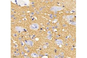 Immunohistochemistry analysis of paraffin-embedded mouse brain using,KCC2 (ABIN7075650) at dilution of 1: 1800 (KCC2 抗体)