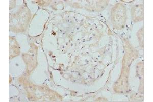 Immunohistochemistry (IHC) image for anti-Cytochrome P450, Family 4, Subfamily V, Polypeptide 2 (CYP4V2) (AA 246-525) antibody (ABIN7149277)