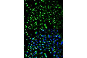 Immunofluorescence analysis of HeLa cell using PHB antibody. (Prohibitin 抗体)