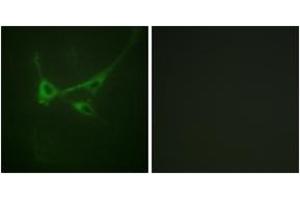 Immunofluorescence analysis of NIH-3T3 cells, using mTOR (Phospho-Ser2481) Antibody. (MTOR 抗体  (pSer2481))