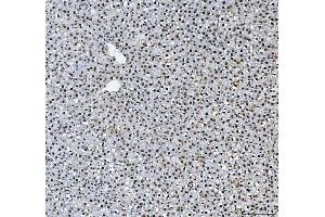 IHC analysis of HNRNPL using anti-HNRNPL antibody (ABIN4886624).