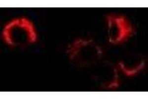 Immunofluorescent analysis of Sorbitol Dehydrogenase staining in MCF7 cells. (SORD 抗体)