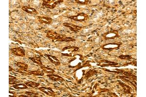 ABIN7094274 and ABIN7098321 at 1/100 staining Rat kidney tissue by IHC-P. (HERPUD2 抗体  (N-Term))