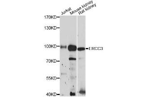 Western blot analysis of extracts of various cell lines, using ERCC3 antibody (ABIN6290288) at 1:3000 dilution. (ERCC3 抗体)