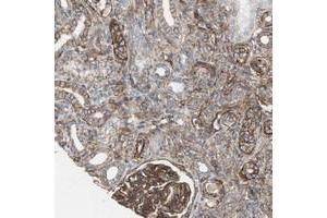 Immunohistochemical staining of human kidney with TCTA polyclonal antibody  shows cytoplasmic positivity in cells in tubules and glomeruli. (TCTA 抗体)