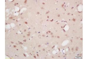 Formalin-fixed and paraffin embedded rat brain labeled with Rabbit Anti-B-Raf (Ser446) Polyclonal Antibody, Unconjugated (ABIN756787) at 1:200 followed by conjugation to the secondary antibody and DAB staining