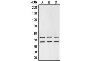 Western blot analysis of GSK3 alpha/beta expression in HEK293T (A), mouse liver (B), PC12 (C) whole cell lysates. (GSK3 alpha/beta 抗体  (Center))